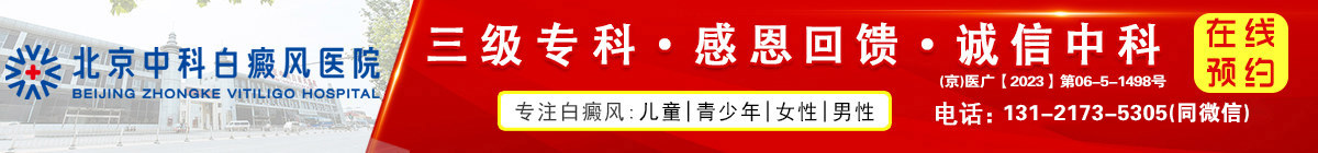 北京中科白癜风医院