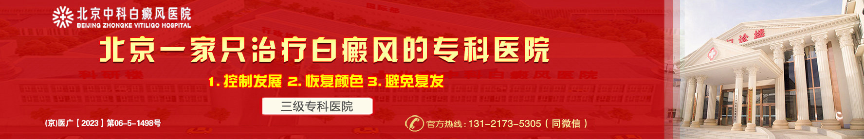 北京白癜风医院