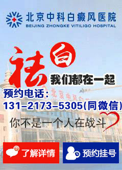 北京白癜风医院哪家好