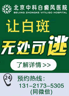 北京白癜风最好医院