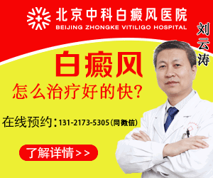 北京白癜风医院哪家好