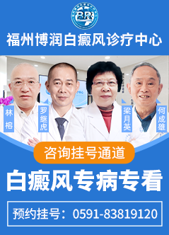 福州治疗白癜风医院