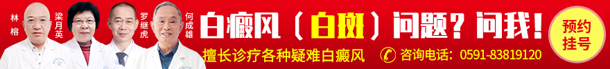 福州博润白癜风