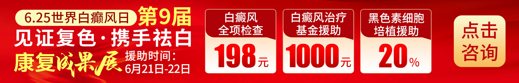 青岛白癜风医院