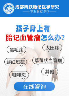 成都好的胎记医院
