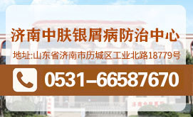 济南牛皮癣医院