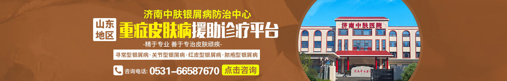 济南牛皮癣医院