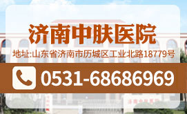 济南牛皮癣医院