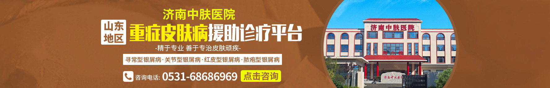 济南牛皮癣医院