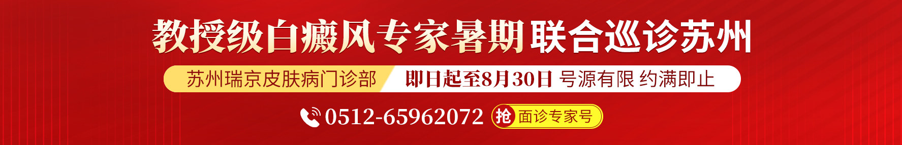 苏州白癜风医院