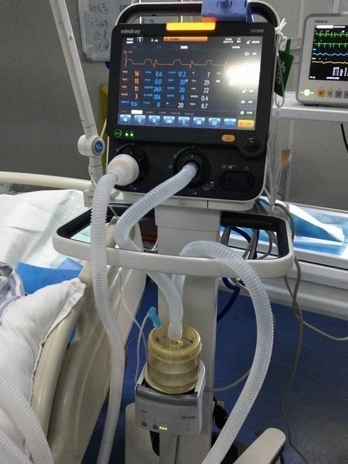 病人上呼吸机真实图片图片