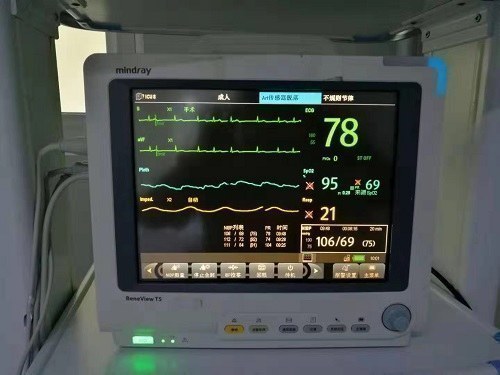 床旁心電監護儀 圖源:會昌縣人民醫院