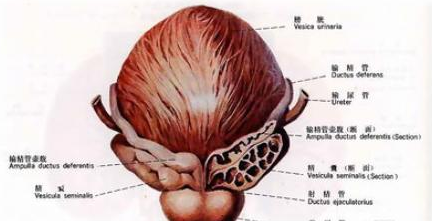 前列腺钙化图解图片