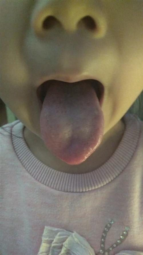 舌苔薄白是怎么回事?