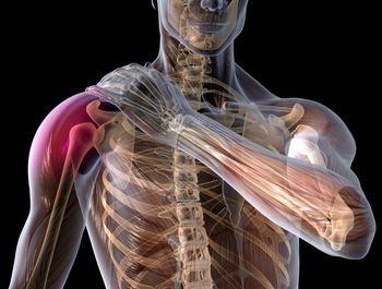 肩肌劳损疼痛位置图图片