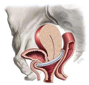 孕期宫颈脱垂图片图片