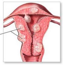 宫颈接触性出血图片