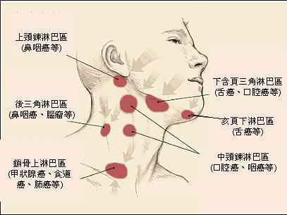 淋巴滤泡增生怎么治图片