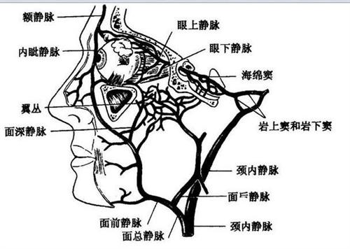 静脉窦位置图片图片