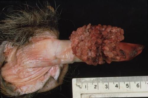 性淋巴肉芽肿初期图片图片