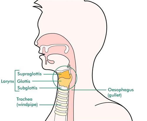 咽喉癌 结构图图片