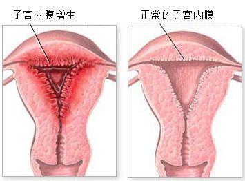 宫颈口不规则形状图片图片
