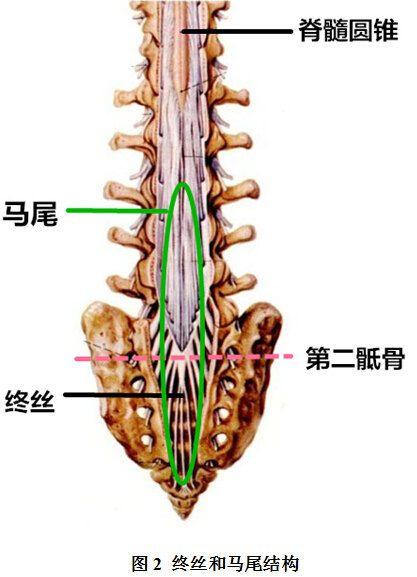 脊髓半横断示意图图片