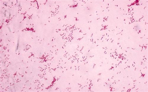 嗜水气单胞菌肠炎