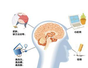 老年人腔隙性腦梗死