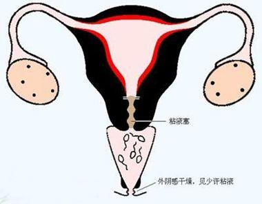 输卵管畸形