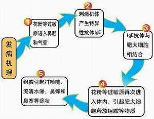 塵蟎過敏性哮喘症狀