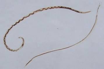 广州管圆线虫病