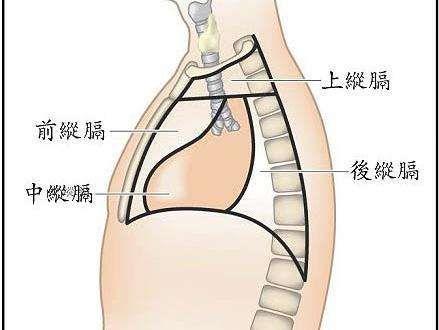 纵隔淋巴结增生